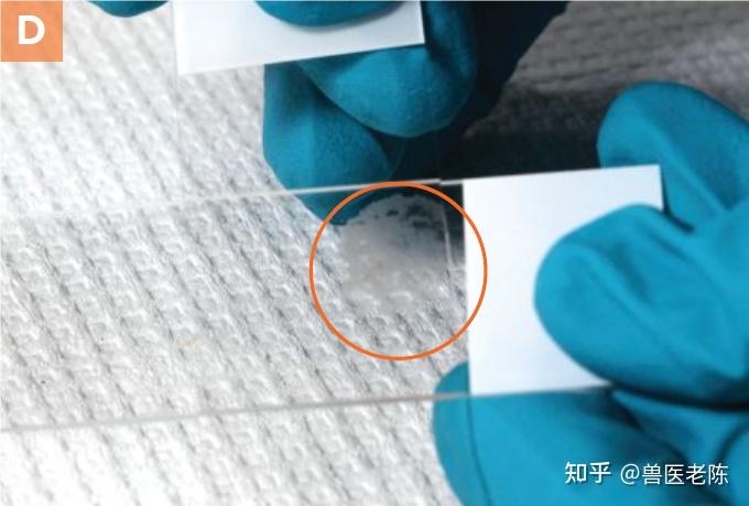 用细针活检法获取细胞学样本 - 知乎