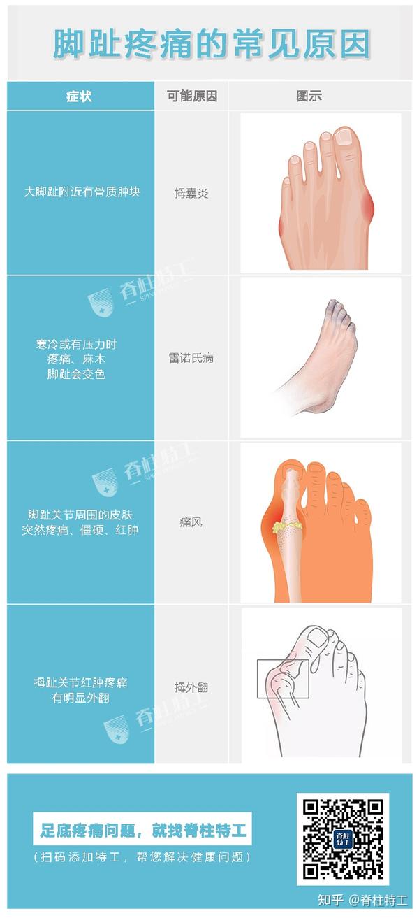 【足部疼痛地图】教你看懂脚痛对应的常见病症 - 知乎