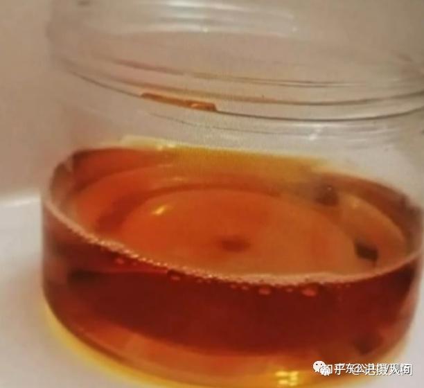 惠州6岁小孩吃了一包零食隔天拉出酱油尿被送医