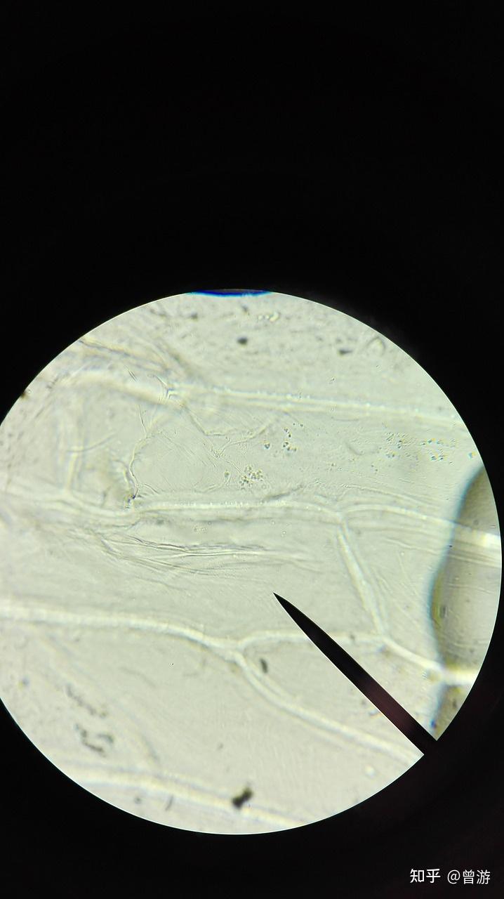 干细胞视网膜再生临床应用的最新进展