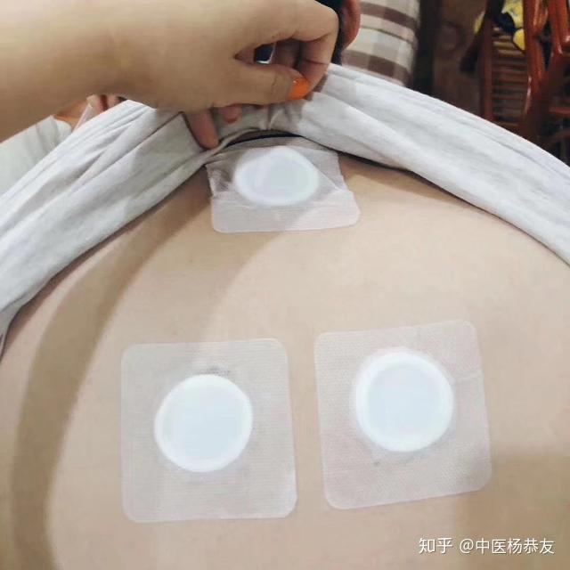 什么才算开放性伤口 v2-361ad6ff2c34ea983ec9580b902a6a6d_r.jpg