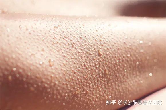 脸胳膊起鸡皮疙瘩(脸胳膊起鸡皮疙瘩痒)
