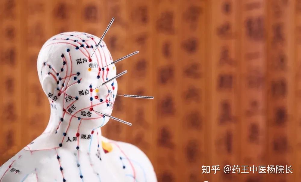 针灸刺法全过程图解，终生受益的中医精粹！ - 知乎