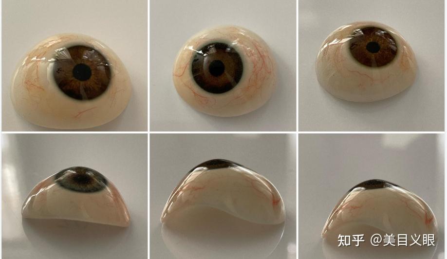 义眼能看见吗？适合哪些人佩戴？ - 知乎