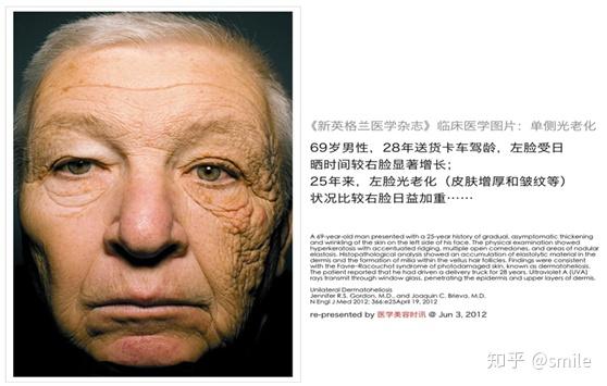 防晒做到位，直面这看脸的社会 - 知乎