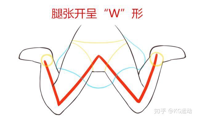 m型腿坐姿疼图片