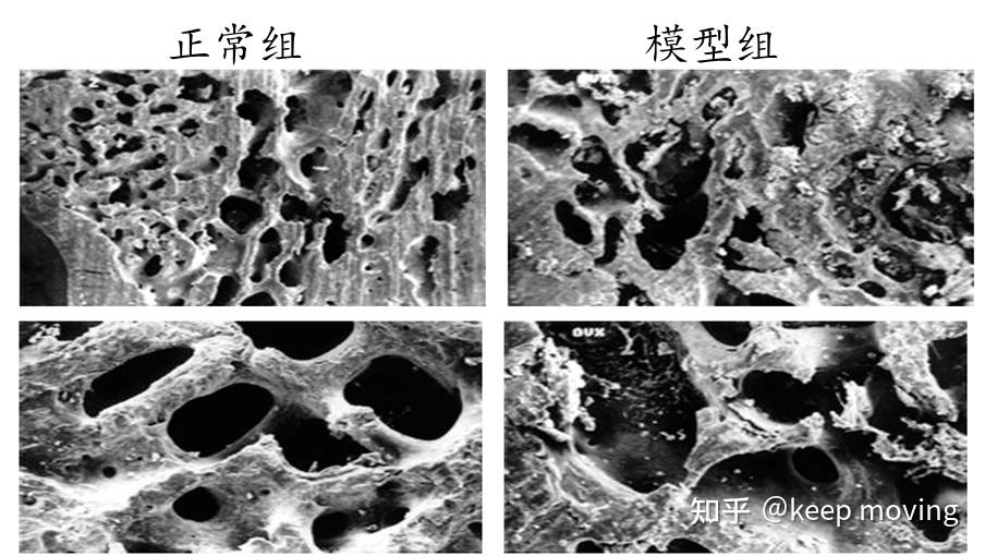 骨组织结构及骨质疏松模型 - 知乎