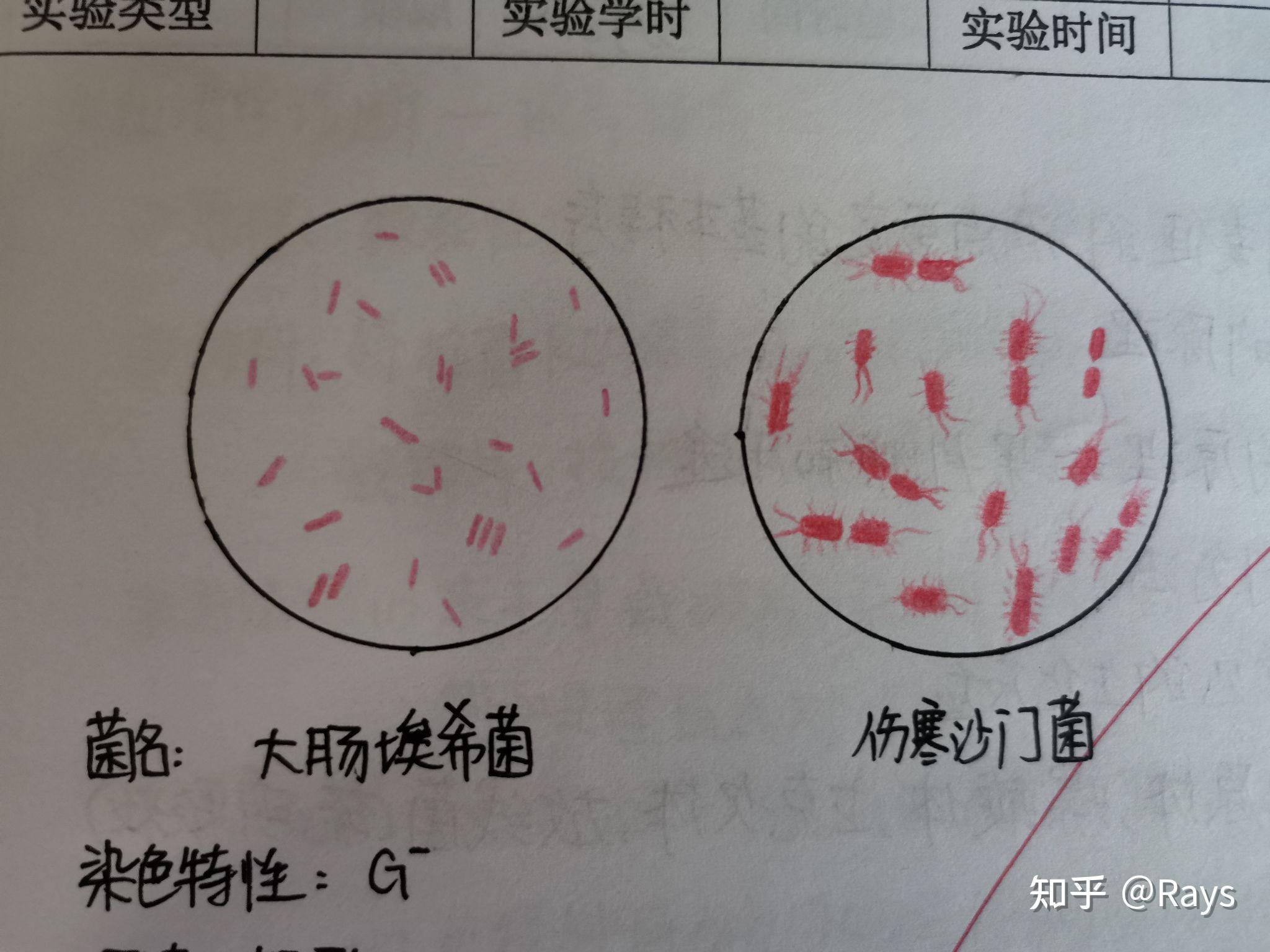 鼠疫耶尔森菌手绘图图片