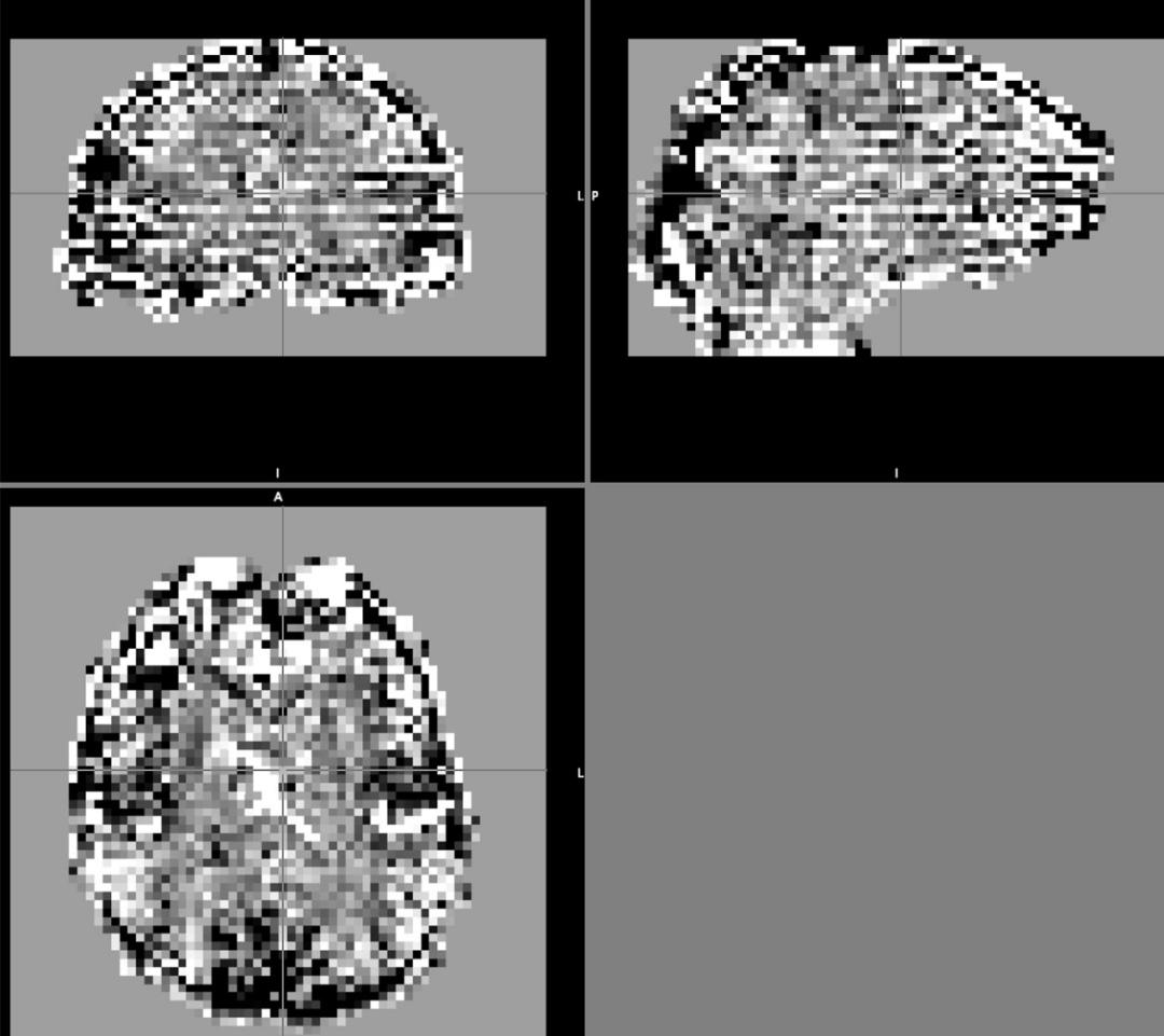 干货 | 实用指南之fMRI表征相似性分析 - 知乎