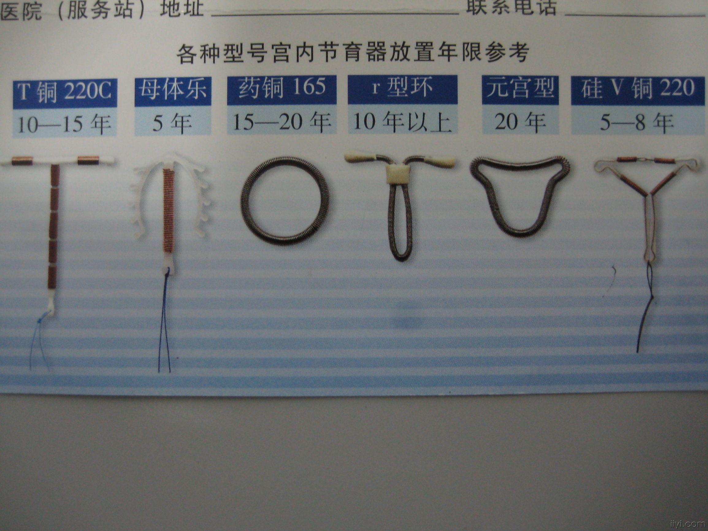 女人带环会意外怀孕吗(为啥带环后易发生宫外孕)