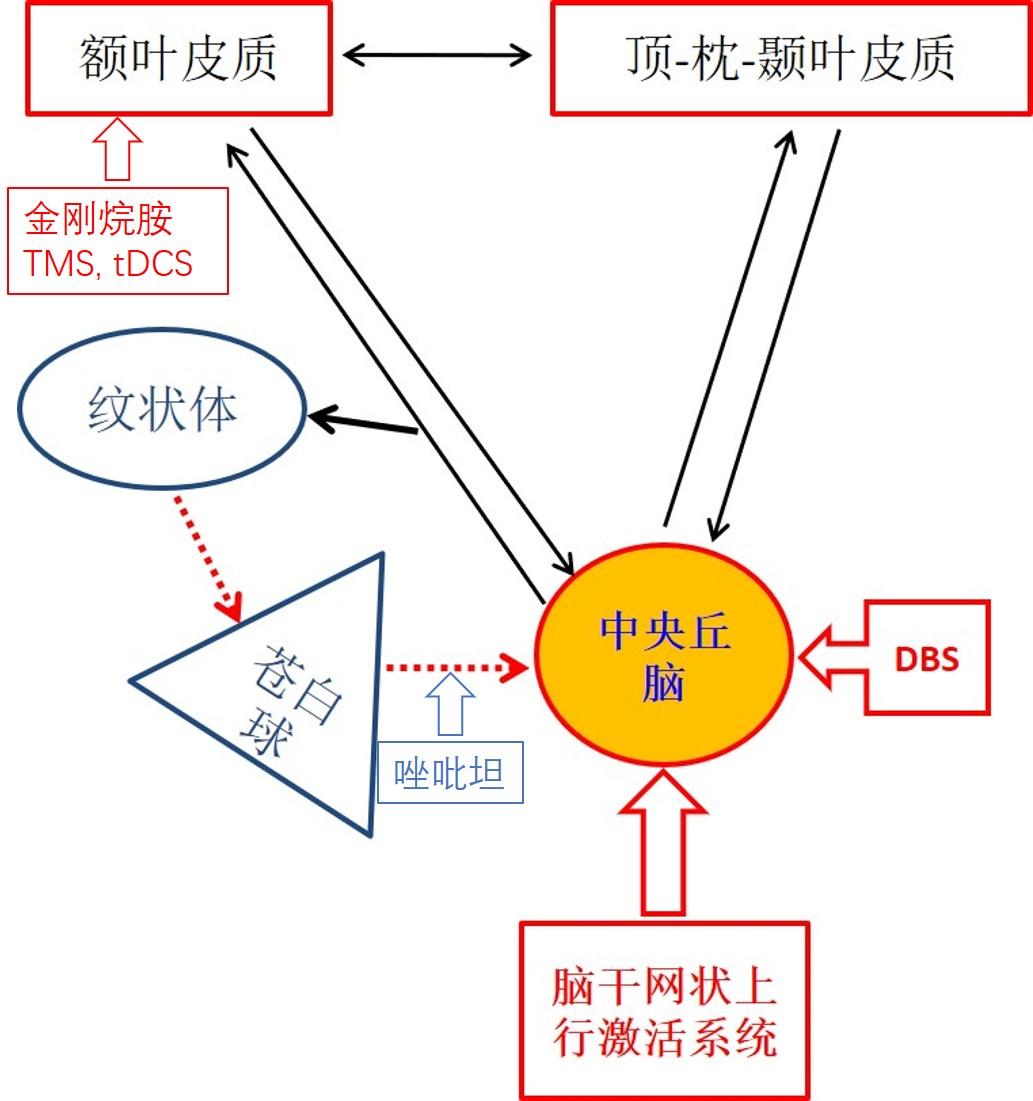 中央丘脑脑深部电刺激治疗长期意识障碍的临床研究 - 知乎