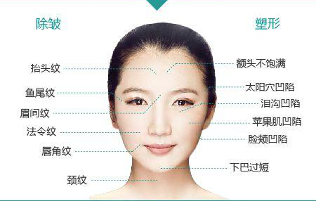 剥离再生术是整形吗