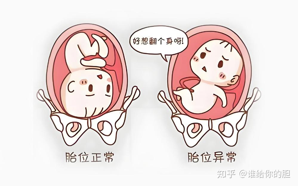 这几类孕妈“开十指”的速度比较慢,看看有没有你 - 知乎