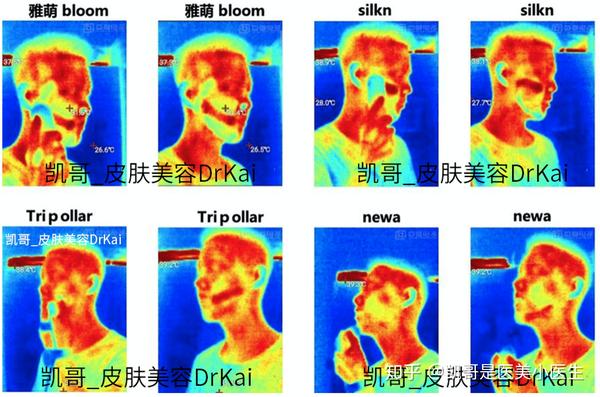 雅萌 Newa Tripollar Silk N 四款家用美容仪器最详细横向测评 知乎