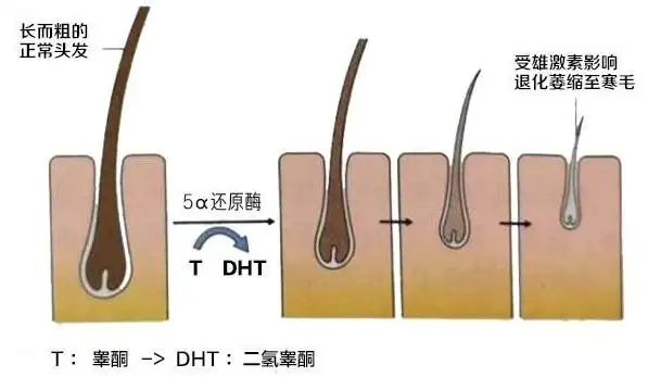 如果毛囊持續萎縮直至死亡,那麼真的很難復活!