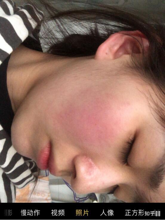 薄皮敏感肌的日常护肤请教
