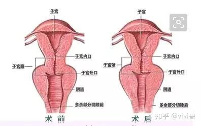 v2-37a9c4c41acc4449f469e63827009395_b.jpg