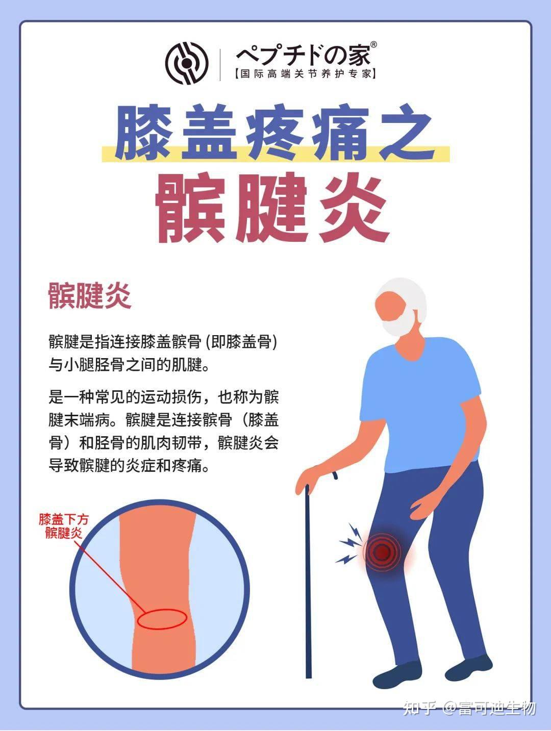 髌腱炎的症状有哪些?