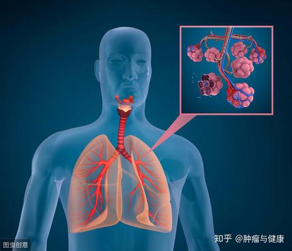确诊肺癌有哪些诊断依据呢 验血可以查出肺癌吗 肺癌血液可以查出来吗 人社网
