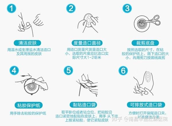 什么是肠造口?第二个肛门?什么情况需要造口呢? - 知乎