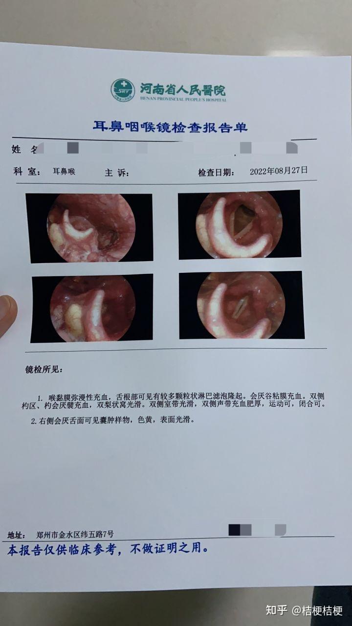 会厌囊肿手术过程图片图片