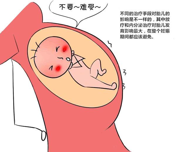 乳腺癌 当妈愿望破灭的恶魔 知乎