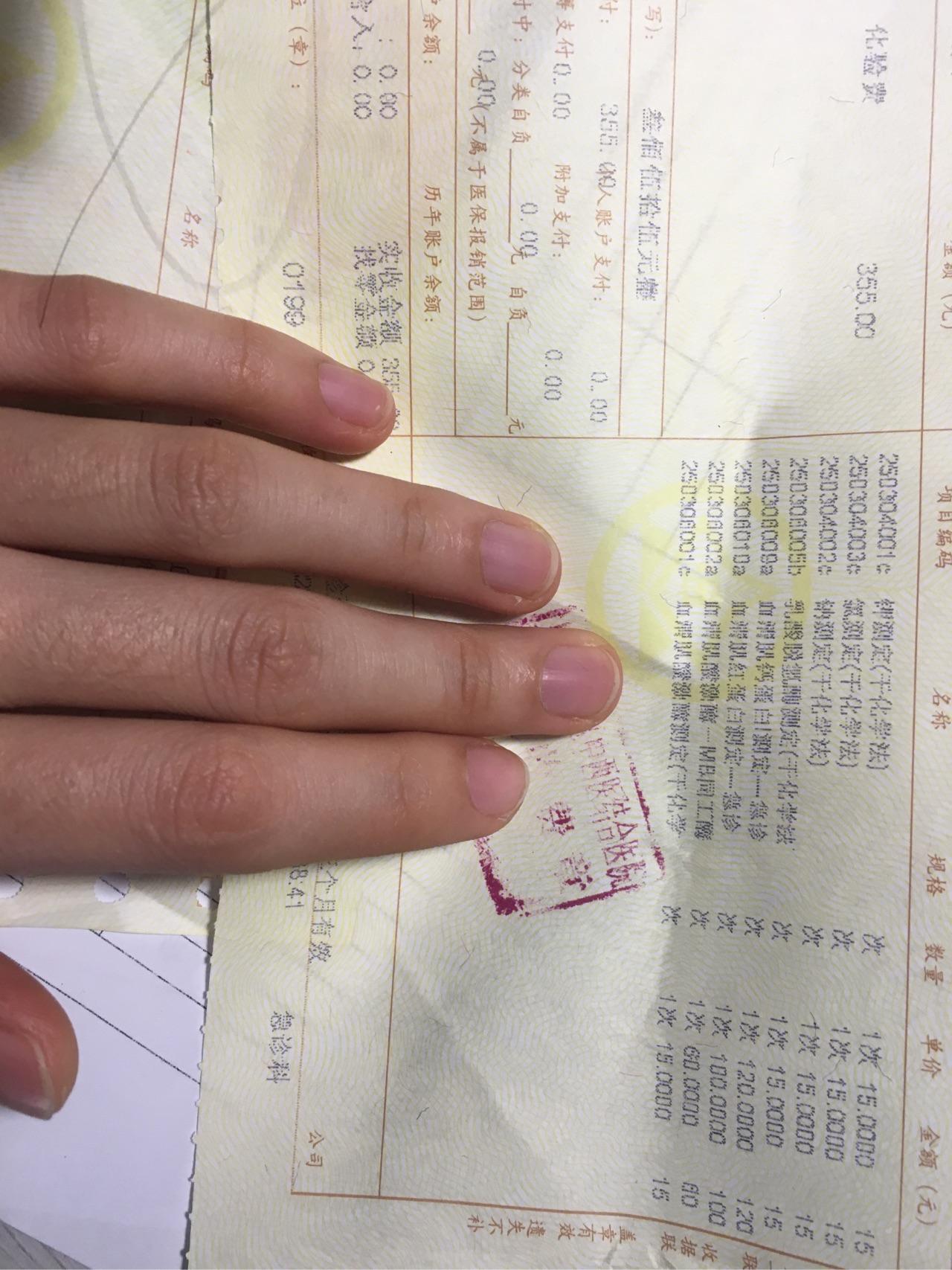 我好像得了焦虑症 心悸 头晕 最近特别明显 洗澡