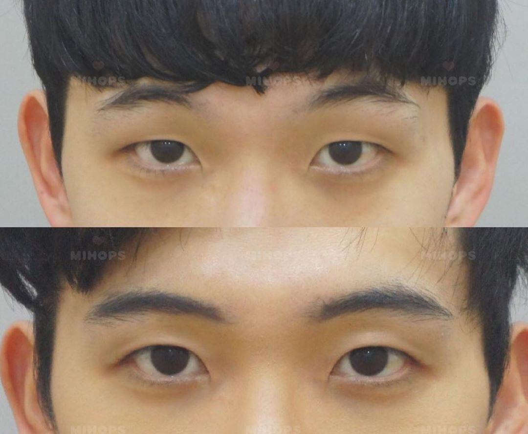 为什么韩国人的单眼皮这么好看 单眼皮不用做双眼皮变好看 知乎 为什么韩国人的单眼皮这么好看 单眼皮不用做双眼皮变好看 知乎