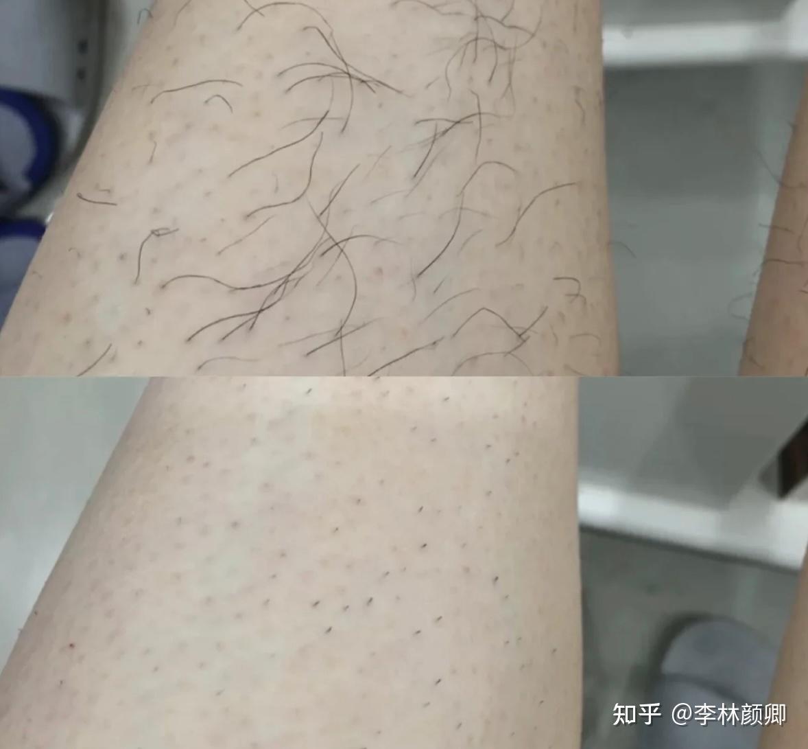 脱毛膏测评靠谱的脱毛膏肉身亲测推荐去黑长粗腋毛手毛性价比直选没有