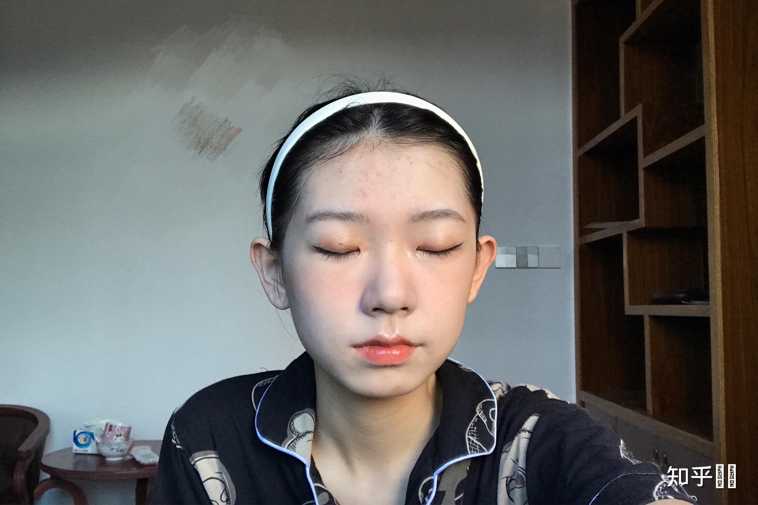 你见过蒜头鼻的美女吗?