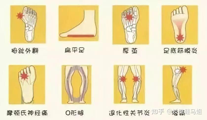 有关Orthopedic骨科矫形、足踝科的问答 - 知乎