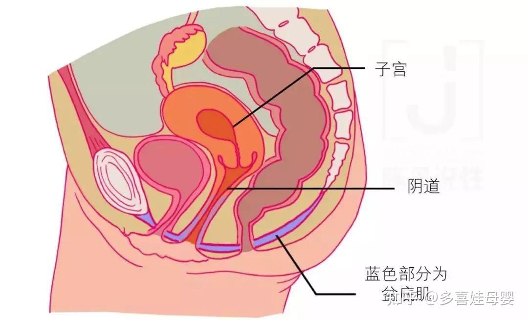 顺产撕裂示意图图片