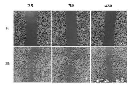 细胞划痕实验结果图图片