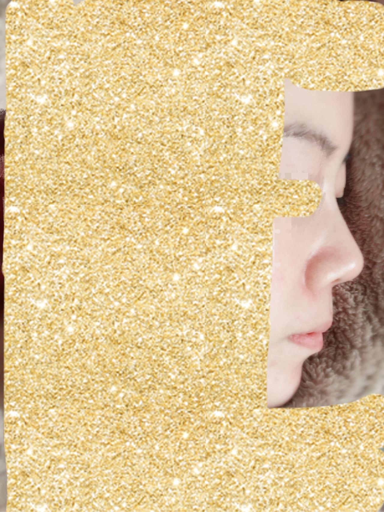 关于垫鼻梁的纪录和分享5