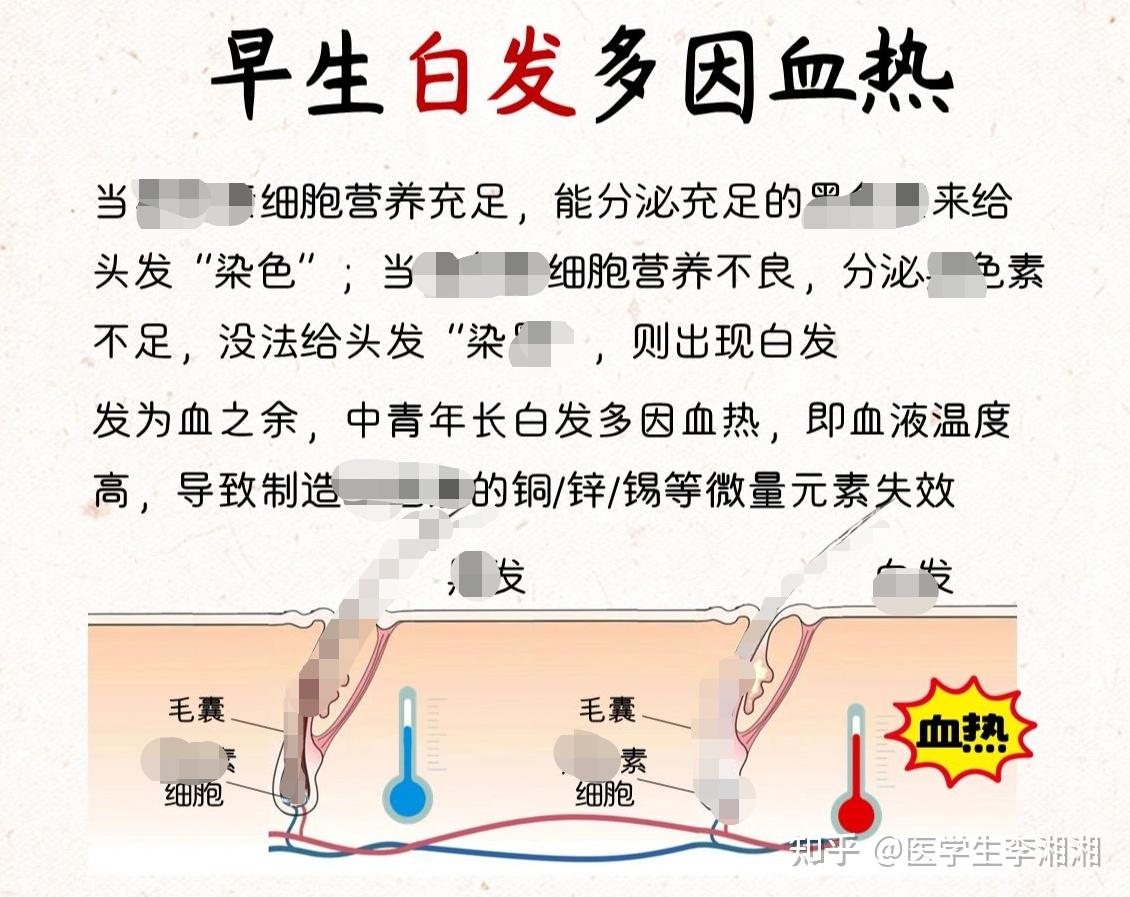 为什么说出现白发是因为血热?想要从根本上改善少白头究竟该如何做?