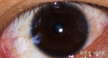 v2-3961736cbe0a3871f8888b9ba03a2bed_b.jpg