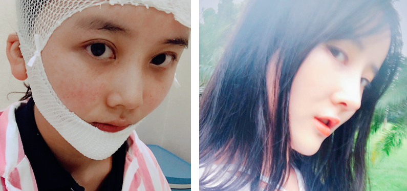 v2-3962d96f75f27bf2e465b31ec855427e_1440w.jpg?source=172ae18b