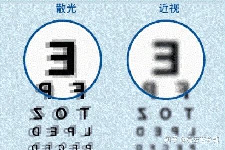 散光度数会随着年龄的增长而增长吗? - 知乎