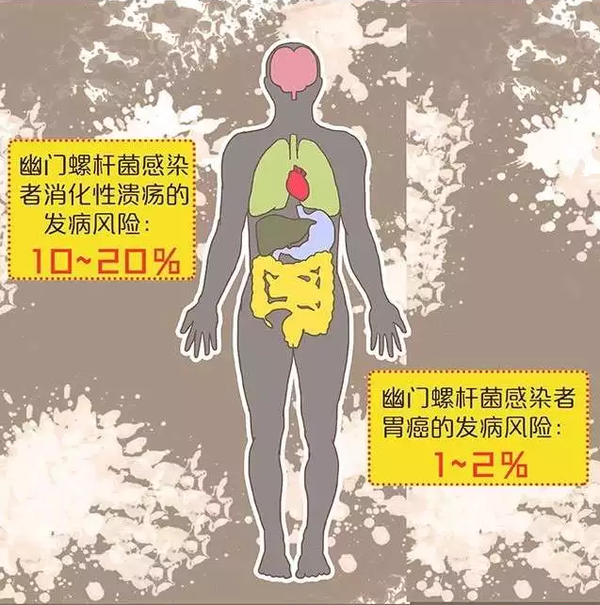你也许在胃癌的队伍中,感染幽门螺杆菌的危害有多大? - 知乎