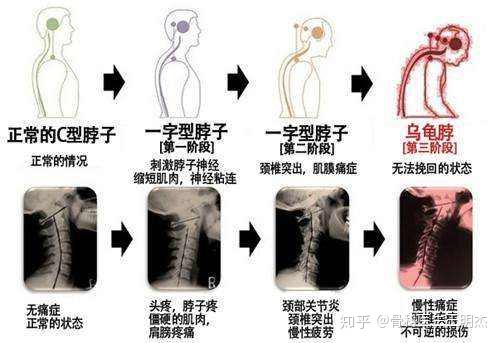 哪个动作可以降血压 v2-39b5452515f754b972d6497bf34bcd59_r.jpg