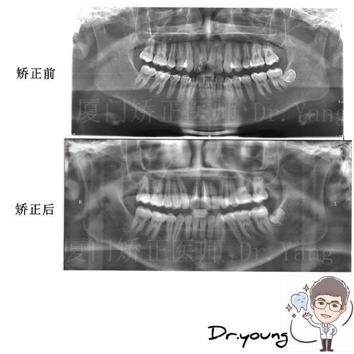 v2-39d4dee51893b2fc59dafebcf3d6fe3d_r.jpg