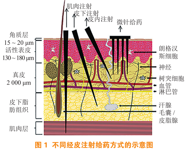 透皮新技术--可溶性微针 - 知乎