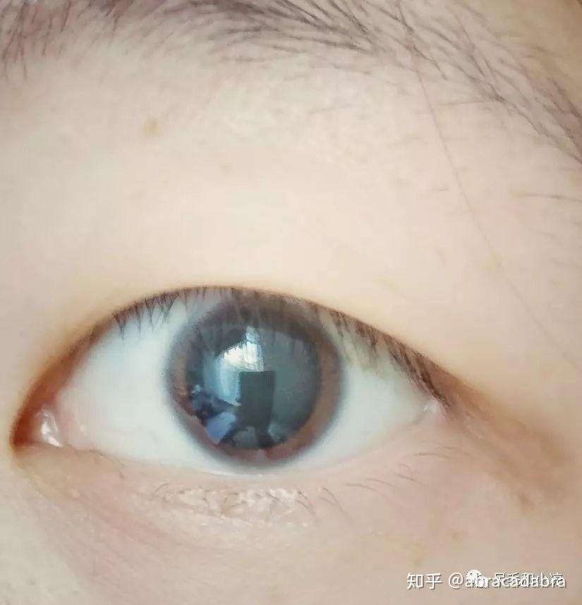 四次药水滴完之后,照了下镜子,发现瞳孔已经完全散了,变成了这样.