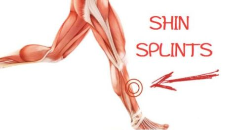 跑步小腿痛?请警惕!跑者杀手-胫痛症候群
