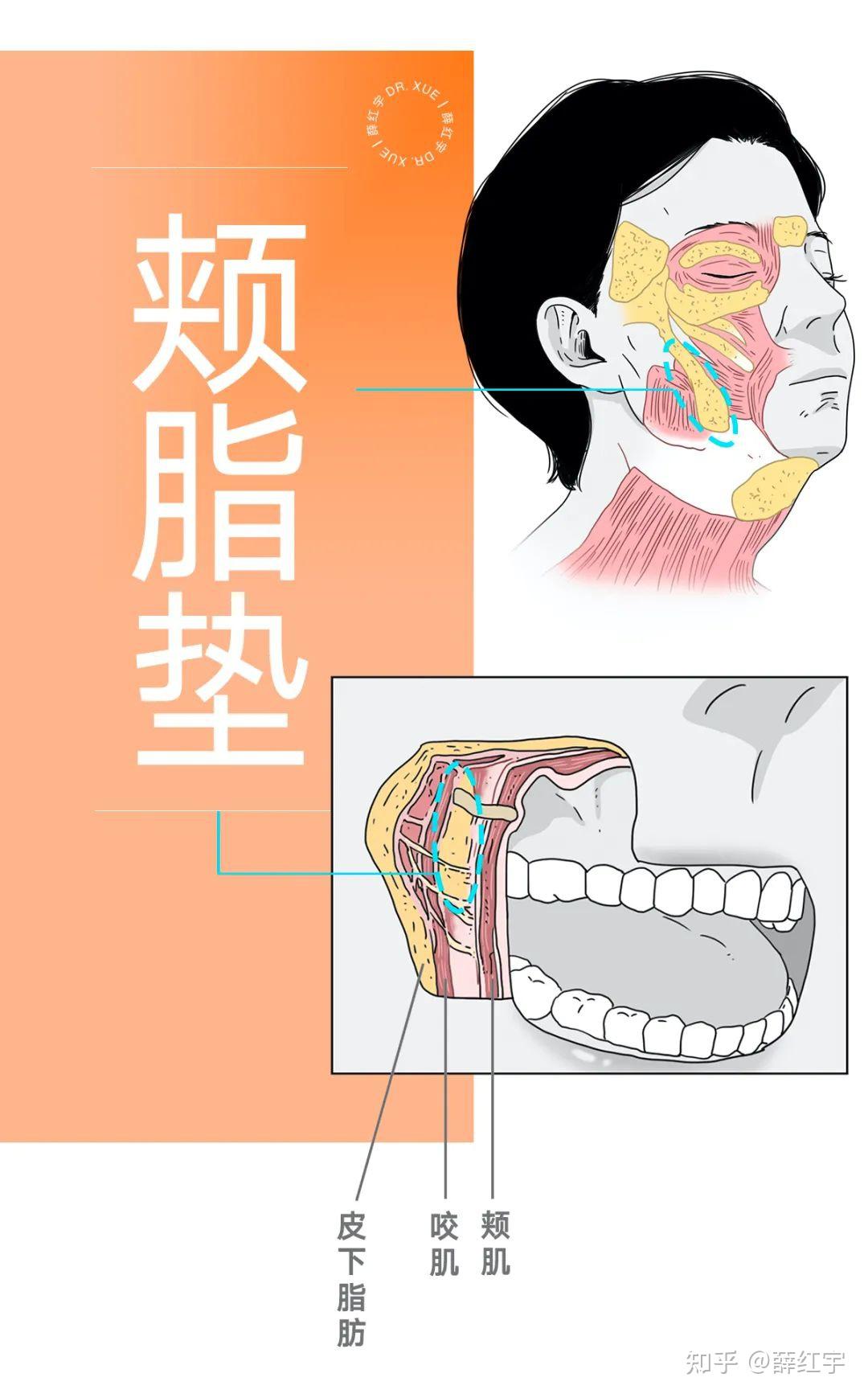 新生儿脂肪垫图片