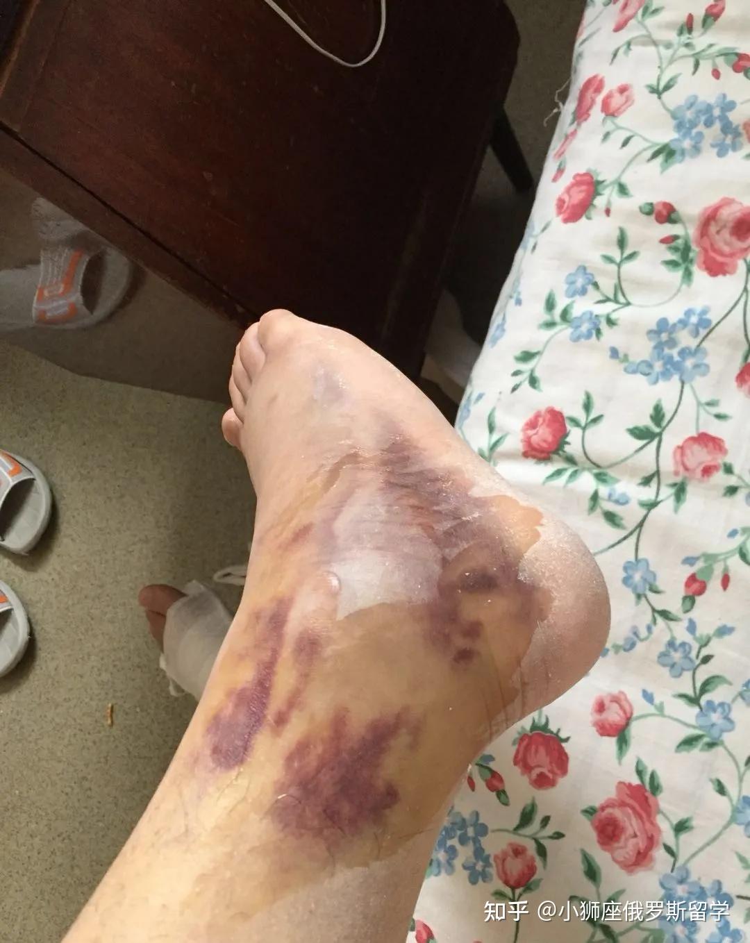 俄罗斯留学医学专业是坑吗为什么不建议俄罗斯留学选择医学专业