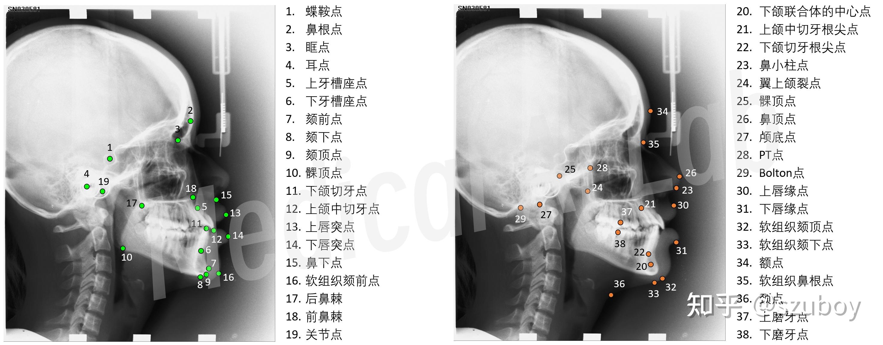 MICCAI CL-Detection2023:头影X光图像关键点检测挑战赛 - 知乎