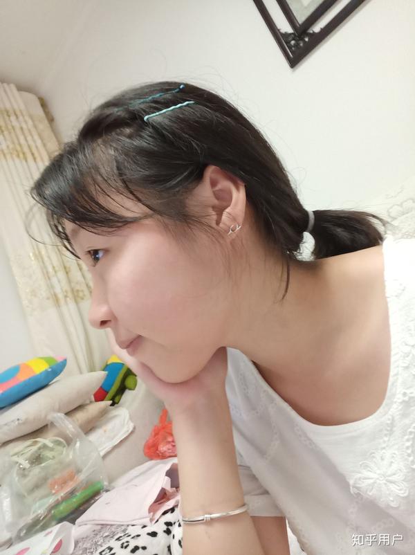 脸鼓没下巴的姑娘怎么变美?是不是没救了…?