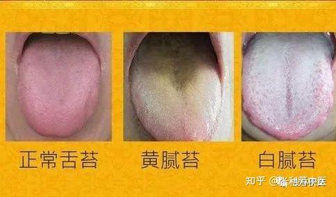 中医舌诊口诀!建议收藏! - 知乎