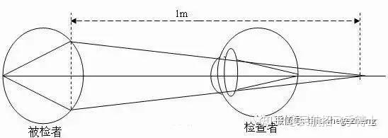 招飞体检眼科科普之:屈光度